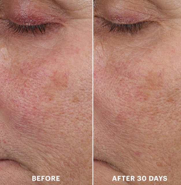 Glo Skin Beauty Bio-Renew EGF Rich Repair Cream