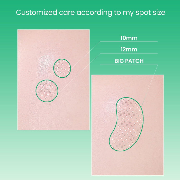 ILSO No Problem Spot Patch 72 patches