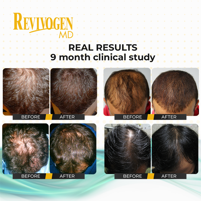 90 Day Scalp Therapy Kit
