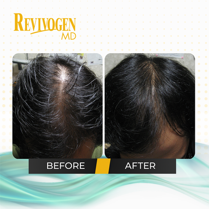 90 Day Scalp Therapy Kit