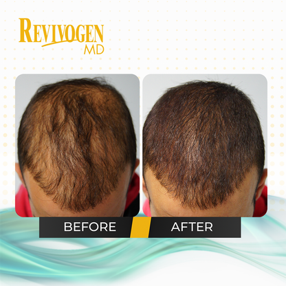 90 Day Scalp Therapy Kit