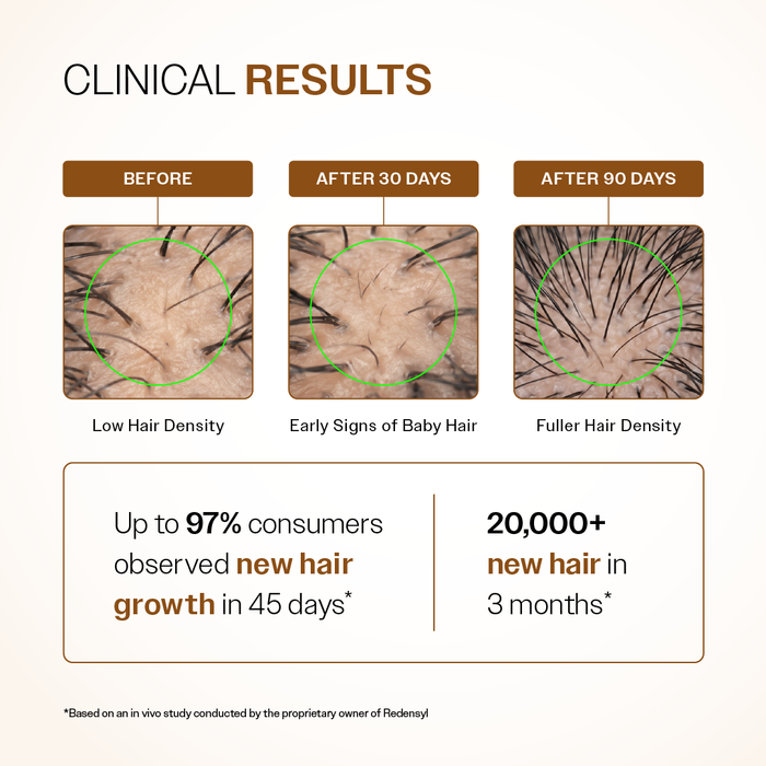 Advanced Hair Growth Serum Spray with 5% Rosemary Extract, 4% Anagain & 3% Redensyl- 30 ml