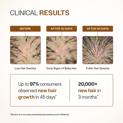 Advanced Hair Growth Serum Spray with 5% Rosemary Extract, 4% Anagain & 3% Redensyl- 30 ml