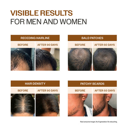 Advanced Hair Growth Serum Spray with 5% Rosemary Extract, 4% Anagain & 3% Redensyl- 30 ml