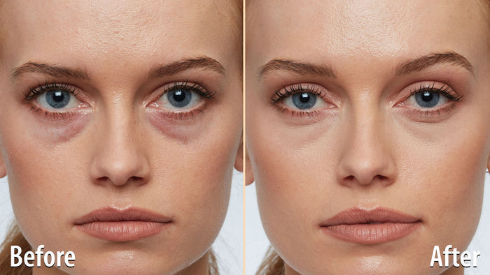 Age Reverse Concealer - Buy 1 Get 1 Free