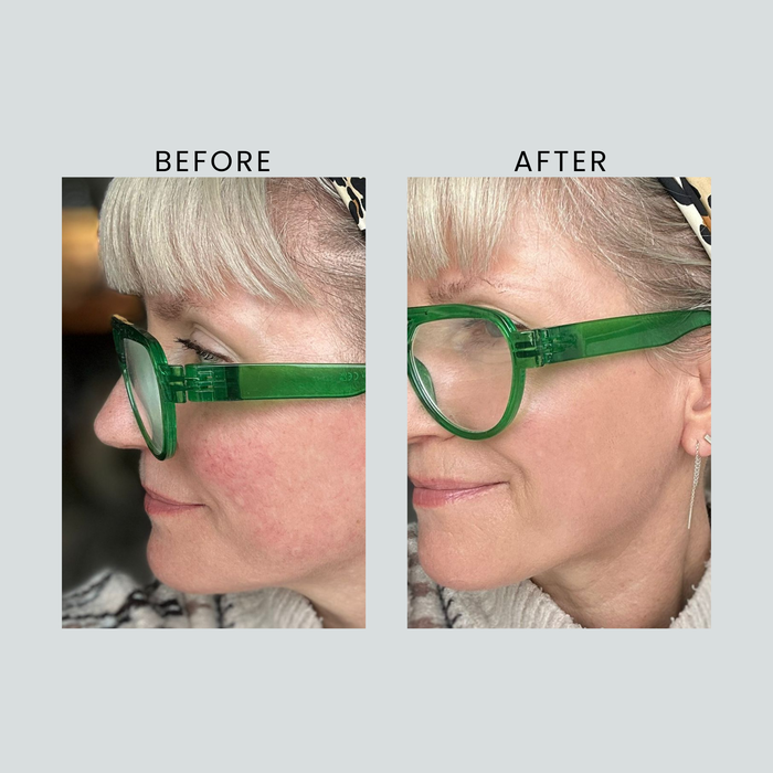 Anti-Redness & Pigmentation Light SPF50 - 30ml