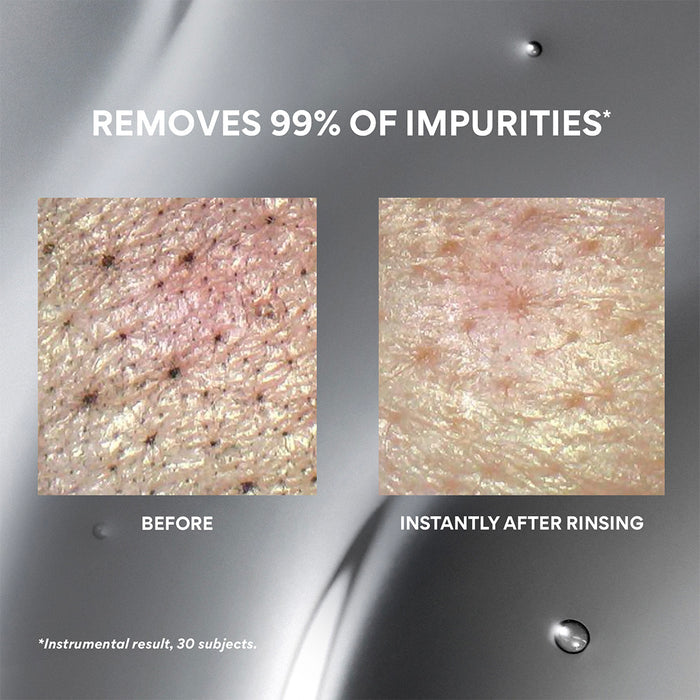 Before-and-after close-up comparison of skin pores and impurities, with text reading 'REMOVES 99% OF IMPURITIES*' and 'BEFORE' / 'INSTANTLY AFTER RINSING' on a metallic gray background.