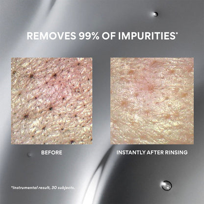 Before-and-after close-up comparison of skin pores and impurities, with text reading 'REMOVES 99% OF IMPURITIES*' and 'BEFORE' / 'INSTANTLY AFTER RINSING' on a metallic gray background.