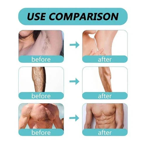 Before and after comparison of hair removal on armpit, leg, and chest showing smooth, hair-free skin