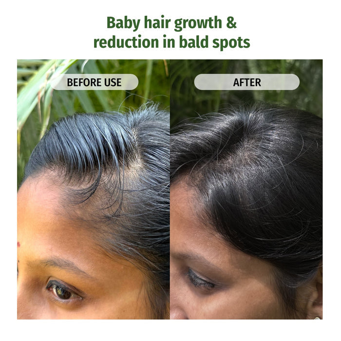 Hair Strengthening Combo