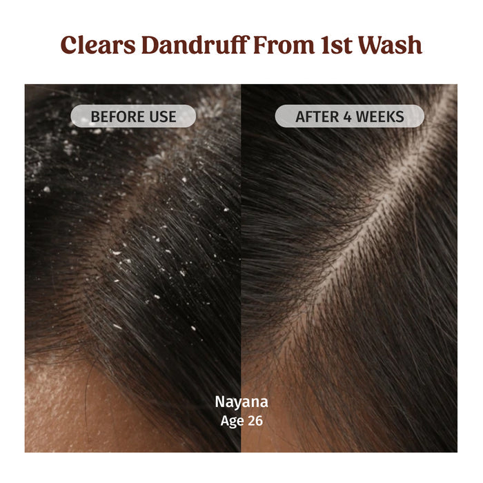 vilvah herbal shampoo clears dandruff