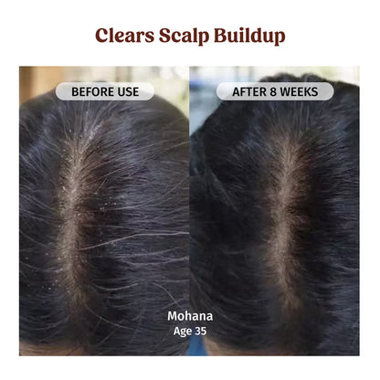 vilvah herbal shampoo 
clears scalp buildup