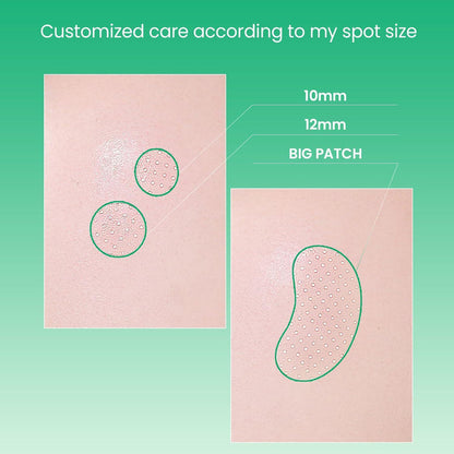 ILSO No Problem Spot Patch 72 patches