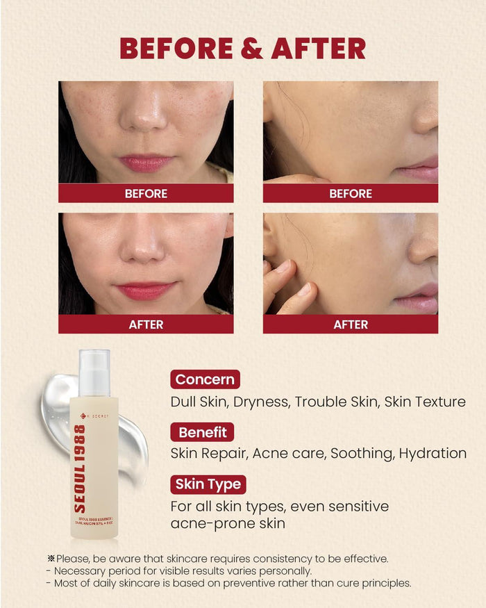 K-SECRET SEOUL 1988 Snail Mucin 97% + Rice Essence 100 mL