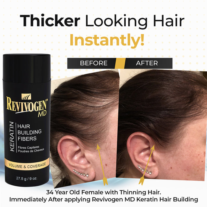 MD Keratin Hair Fibers
