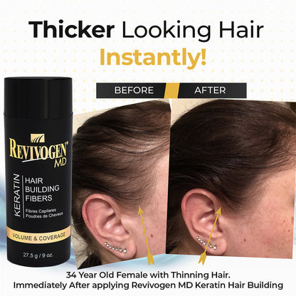 MD Keratin Hair Fibers