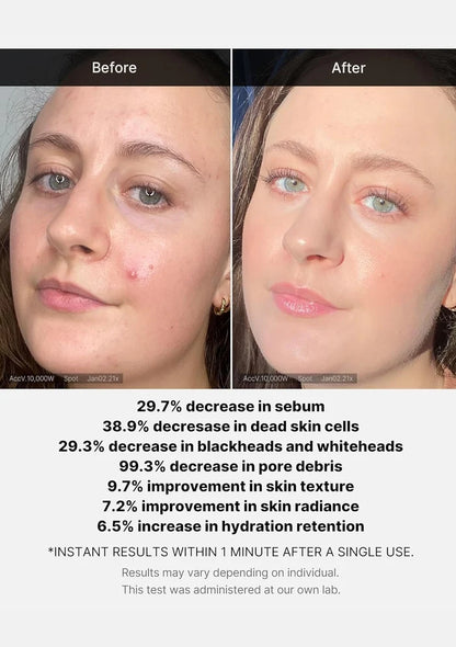 Before and after comparison of a person's face with text detailing skincare improvements.
