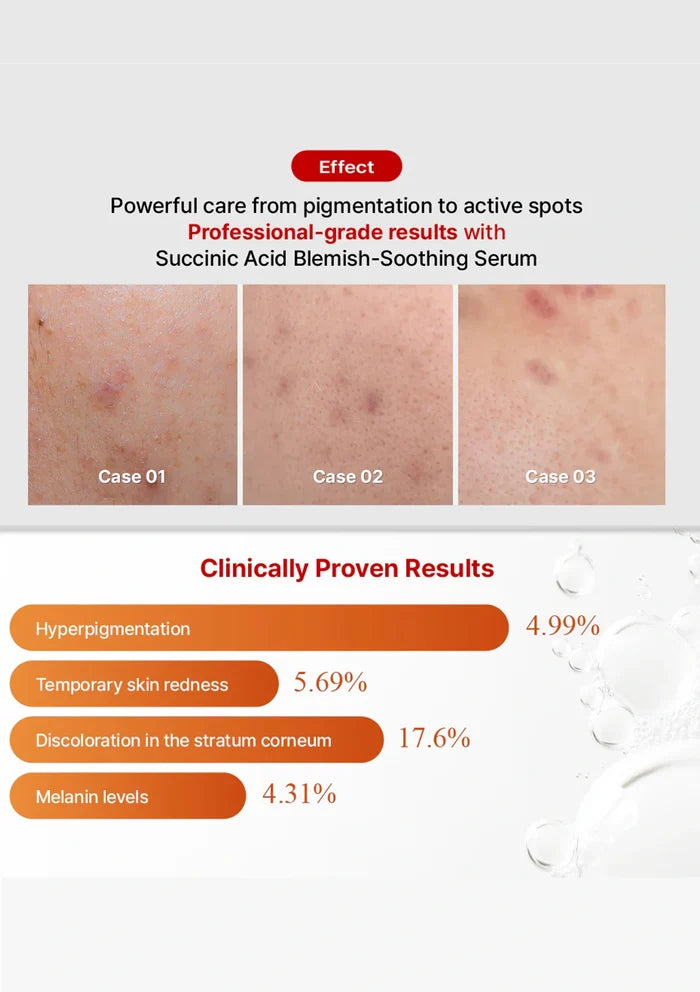 Advertisement for a skincare serum with before-and-after skin condition images and clinical results.