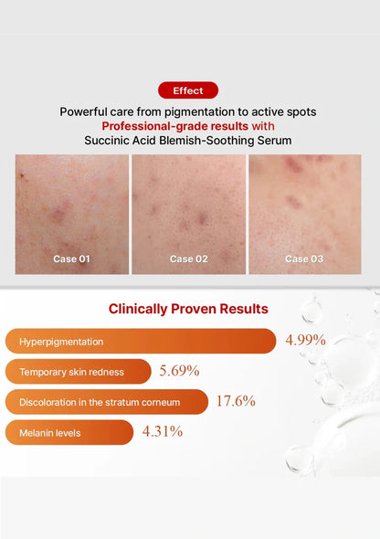 Advertisement for a skincare serum with before-and-after skin condition images and clinical results.