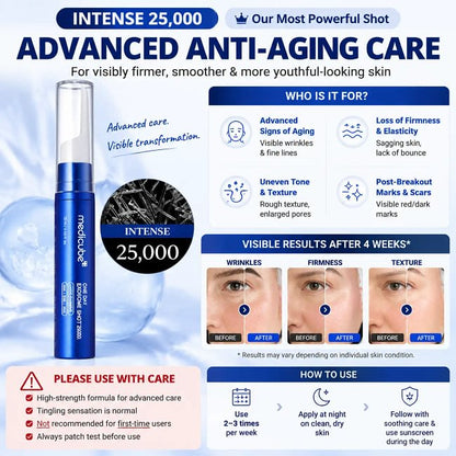 Professional (Intense 25000) / Buy 1