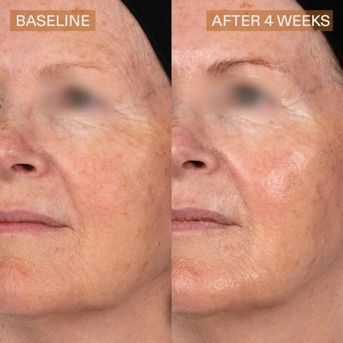 Pro Helix C Serum