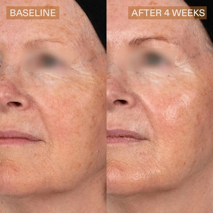 Pro Helix C Serum