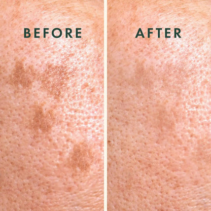 Rael Microcrystal Vitamin C Dark Spot Cover 9 patches