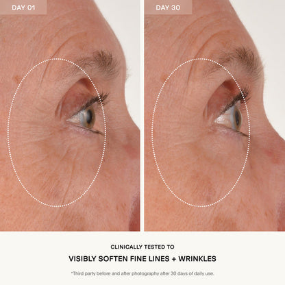 The RETURN Eye Concentrate