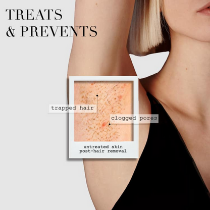 Kaia Naturals-The Takesumi Bright The Ingrown Bar-Body-theingrownbar3-The Detox Market |