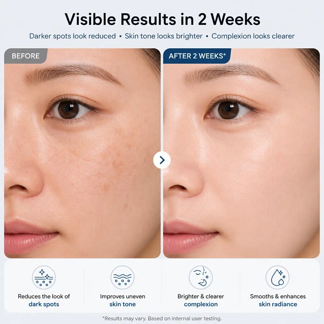 TX Cream 50ml｜Nano-sized Tranexaminc Acid for Dark Spots & Hyperpigmentation