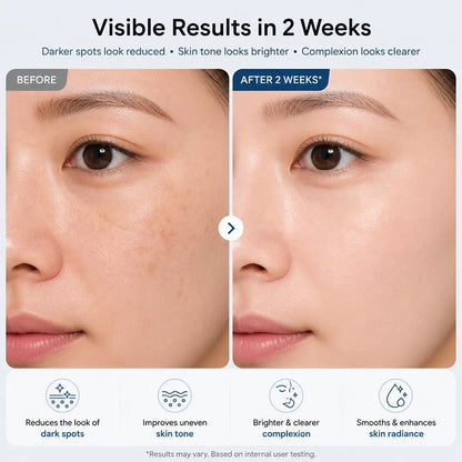 TX Cream 50ml｜Nano-sized Tranexaminc Acid for Dark Spots & Hyperpigmentation